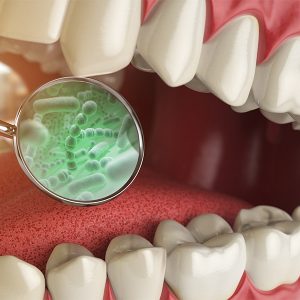 Cuidado: bactérias da boca podem levar a infecções graves