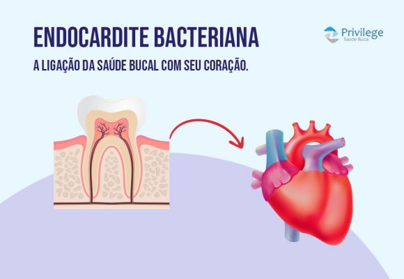 Higiene Bucal e a saúde do seu coração: Endocardite bacteriana